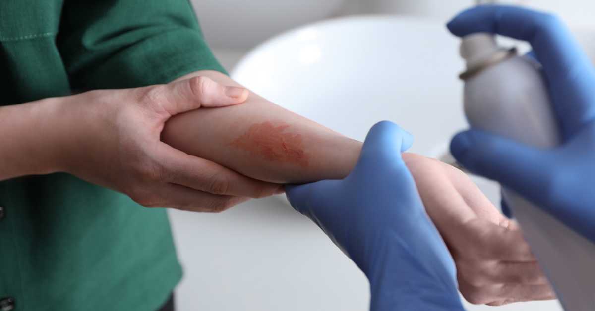 m/دوره آموزش مدیریت زخم